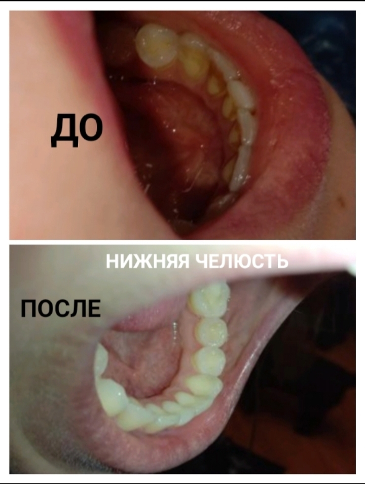 Dentistry free of charge - My, The medicine, Dentistry, Longpost, Dobrovspyshka, No rating, 