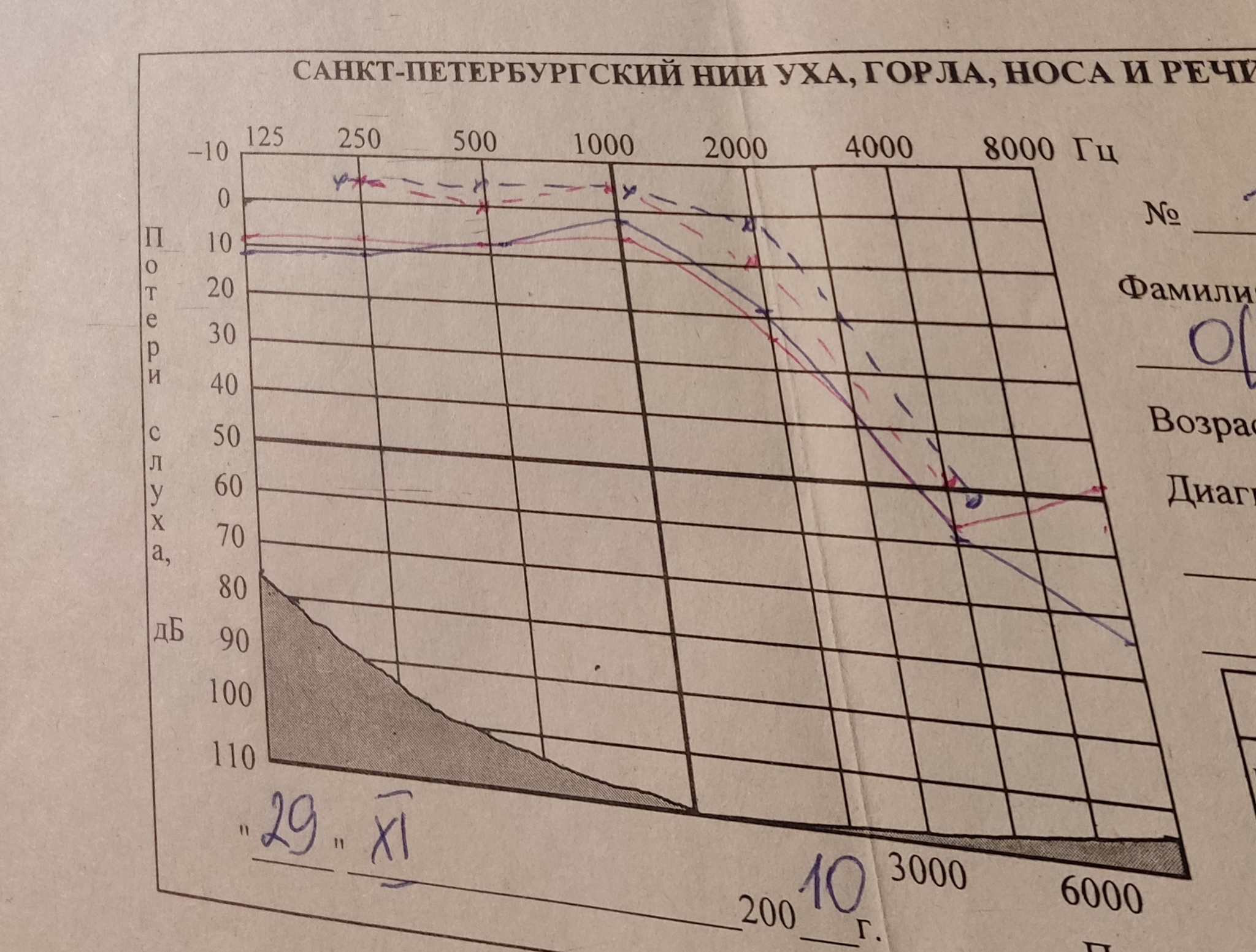 Poor hearing. Diagnosis. What do you recommend? - My, Hearing, Diagnosis, ENT-Doctors, No rating