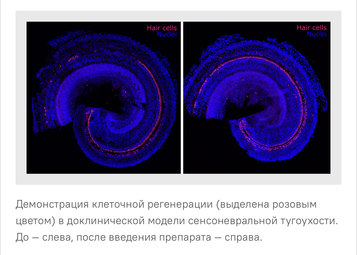 Terrific news. American scientists have developed an injection that returns hearing - Research, Scientists, The science, USA, The medicine, Hearing loss, Hearing aid, Longpost