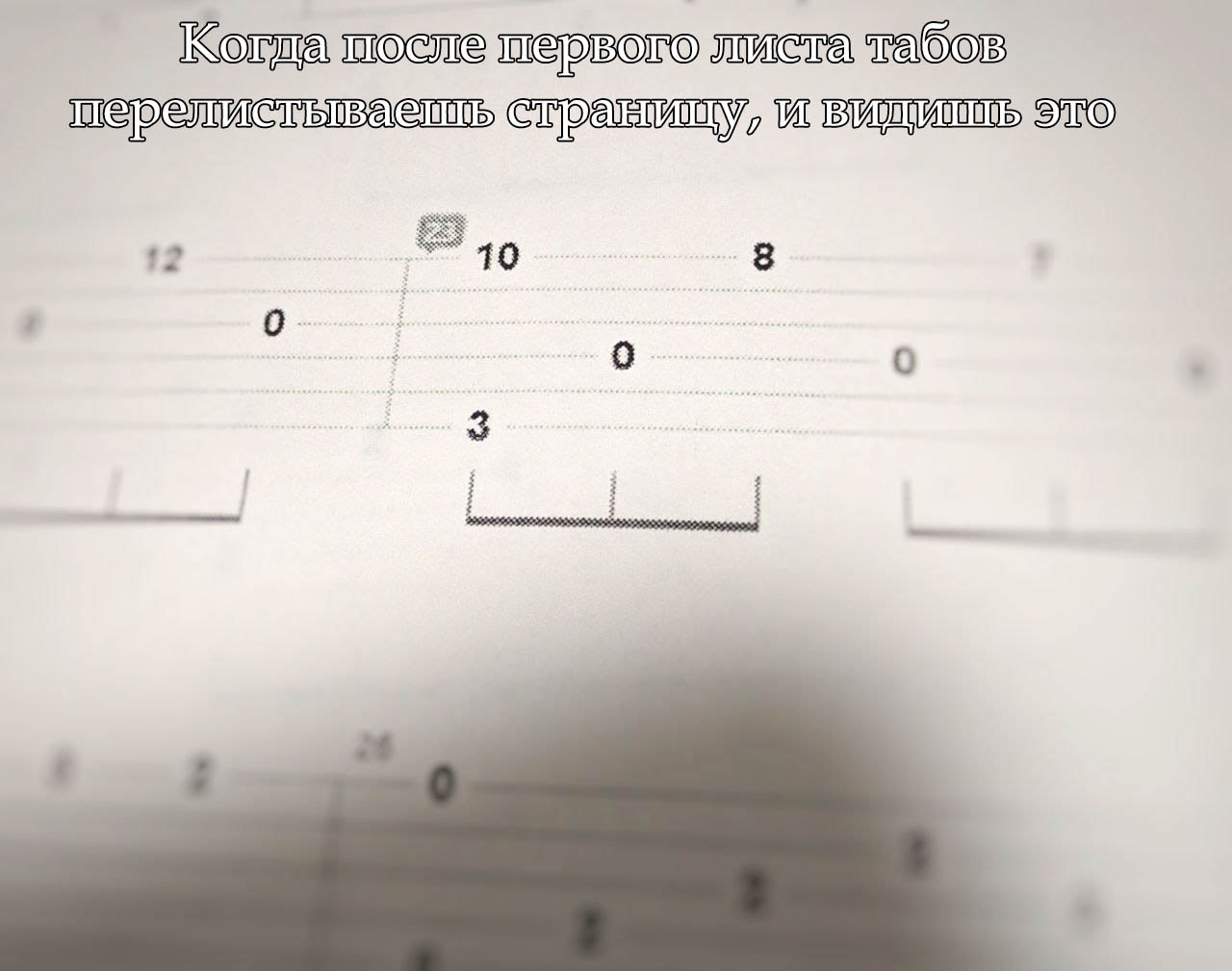 The Pain of an Aspiring Guitarist - My, Guitar, Tabs, Music, Humor, X-ray