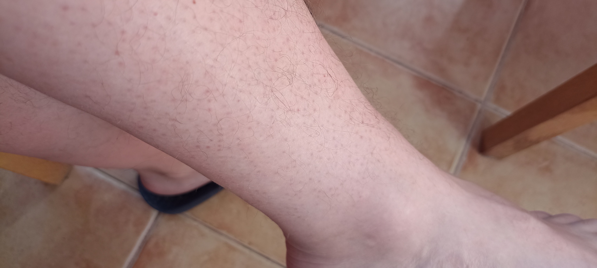 Dermatologists help please post - Dermatology, Problem skin, Need advice