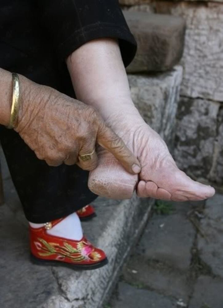 47 shocking pictures of Chinese 'lotus women' feet - Informative, Ugliness, Around the world, Longpost