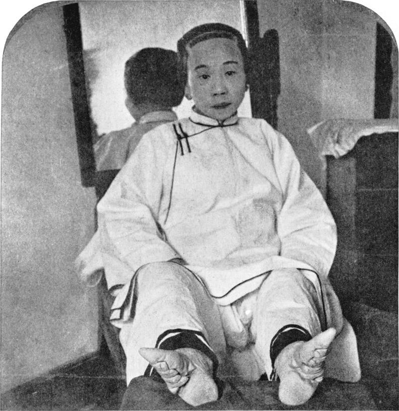 47 shocking pictures of Chinese 'lotus women' feet - Informative, Ugliness, Around the world, Longpost