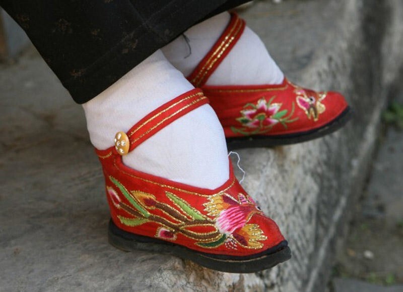 47 shocking pictures of Chinese 'lotus women' feet - Informative, Ugliness, Around the world, Longpost