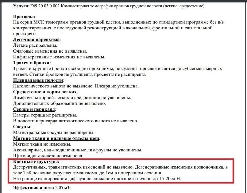 Нужна помощь (неврология) - Здоровье, Болезнь, Диагноз, Без рейтинга, Длиннопост