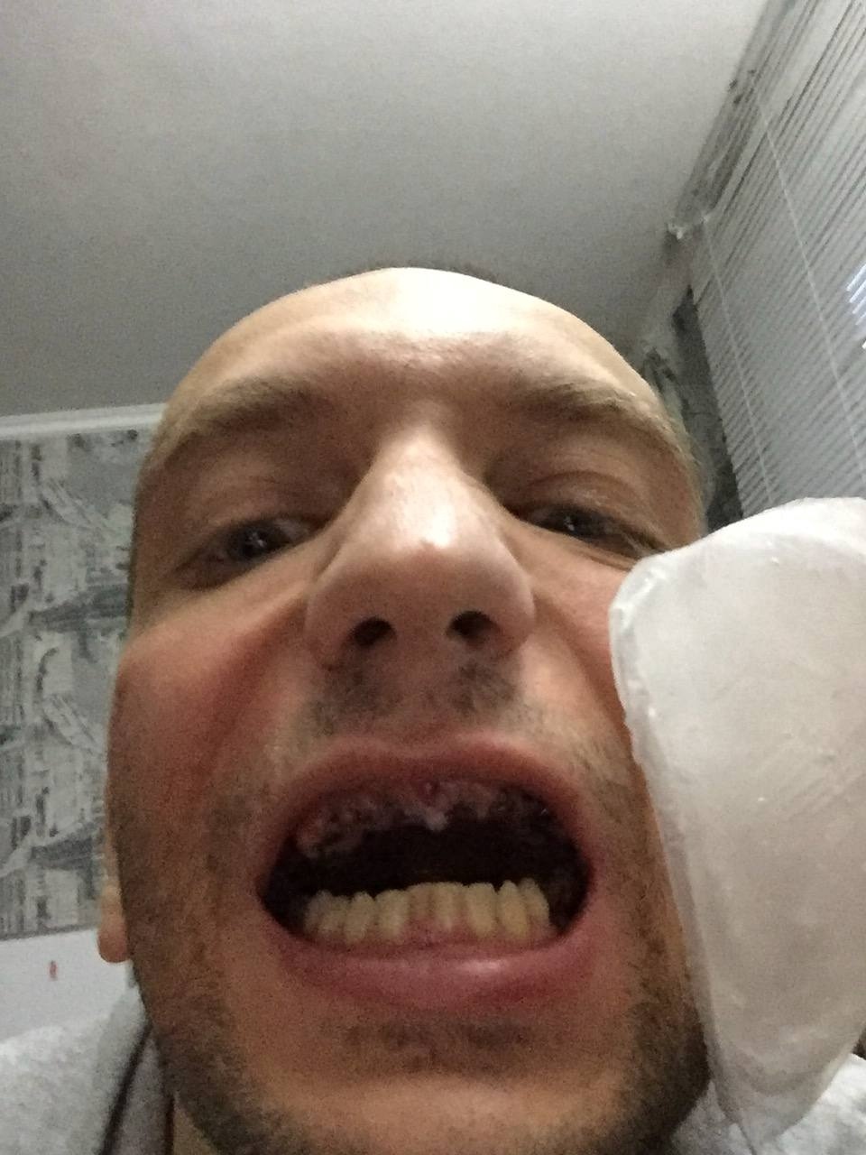 NEVER GIVE UP, YOU CAN! - My, Teeth, Dentistry, Motivation, Mat, Longpost