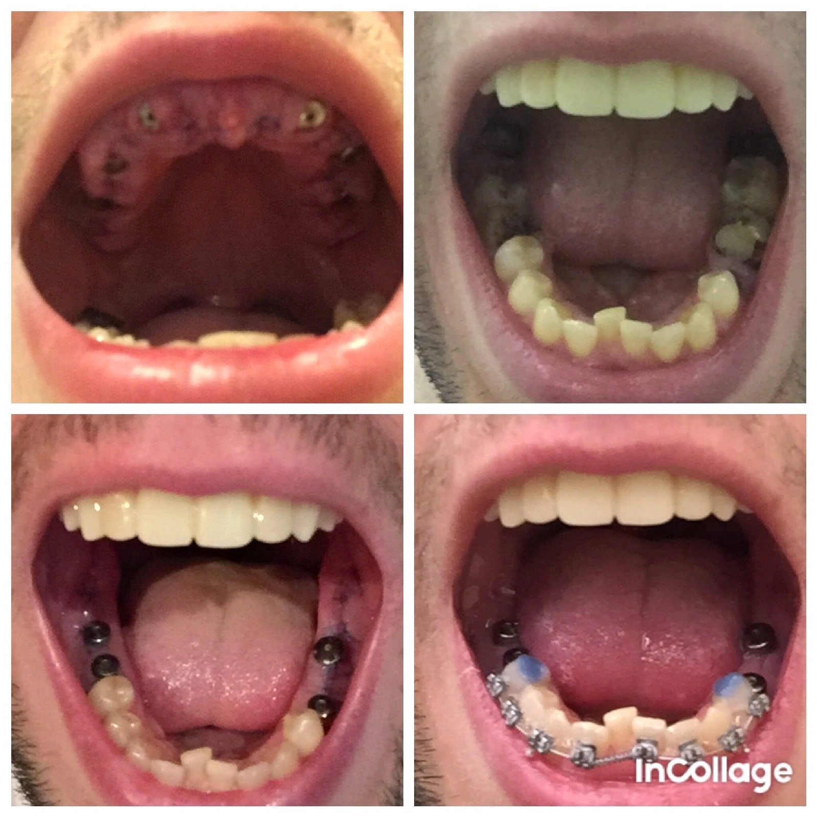 NEVER GIVE UP, YOU CAN! - My, Teeth, Dentistry, Motivation, Mat, Longpost