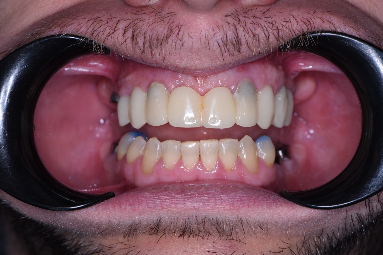 NEVER GIVE UP, YOU CAN! - My, Teeth, Dentistry, Motivation, Mat, Longpost