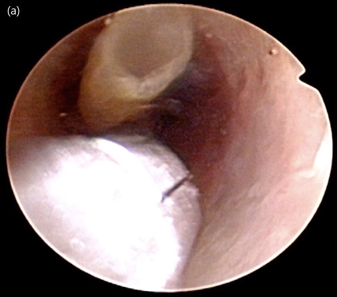 Green onions in the urethra as a method of treating urethral itching - The medicine, Disease history, Treatment, Nauchpop, Longpost