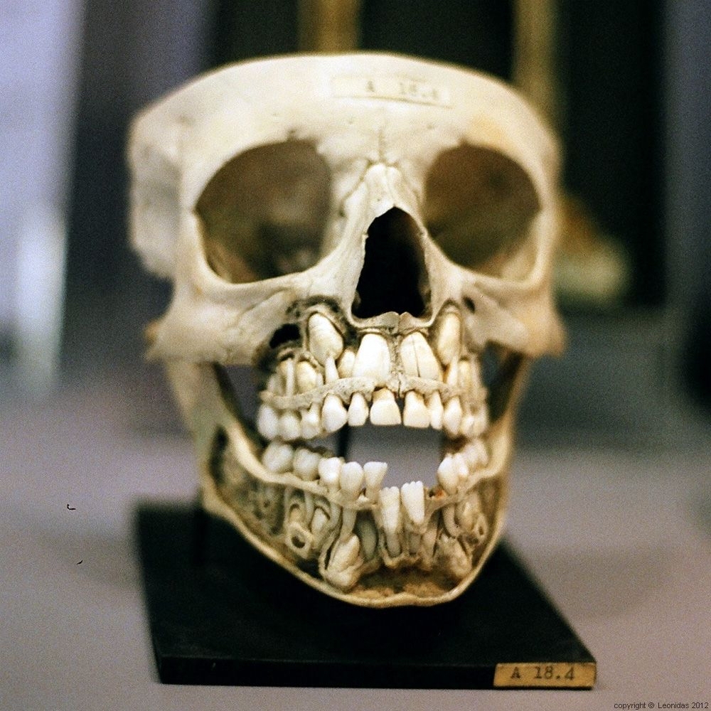 Children's skull before the loss of milk teeth - Scull, Knowledge, Longpost