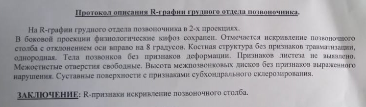 У кого такое было, как обошлось? - Моё, Врачи, Болезнь, Позвоночник, Вертебрология, Без рейтинга, Нужна помощь врачей