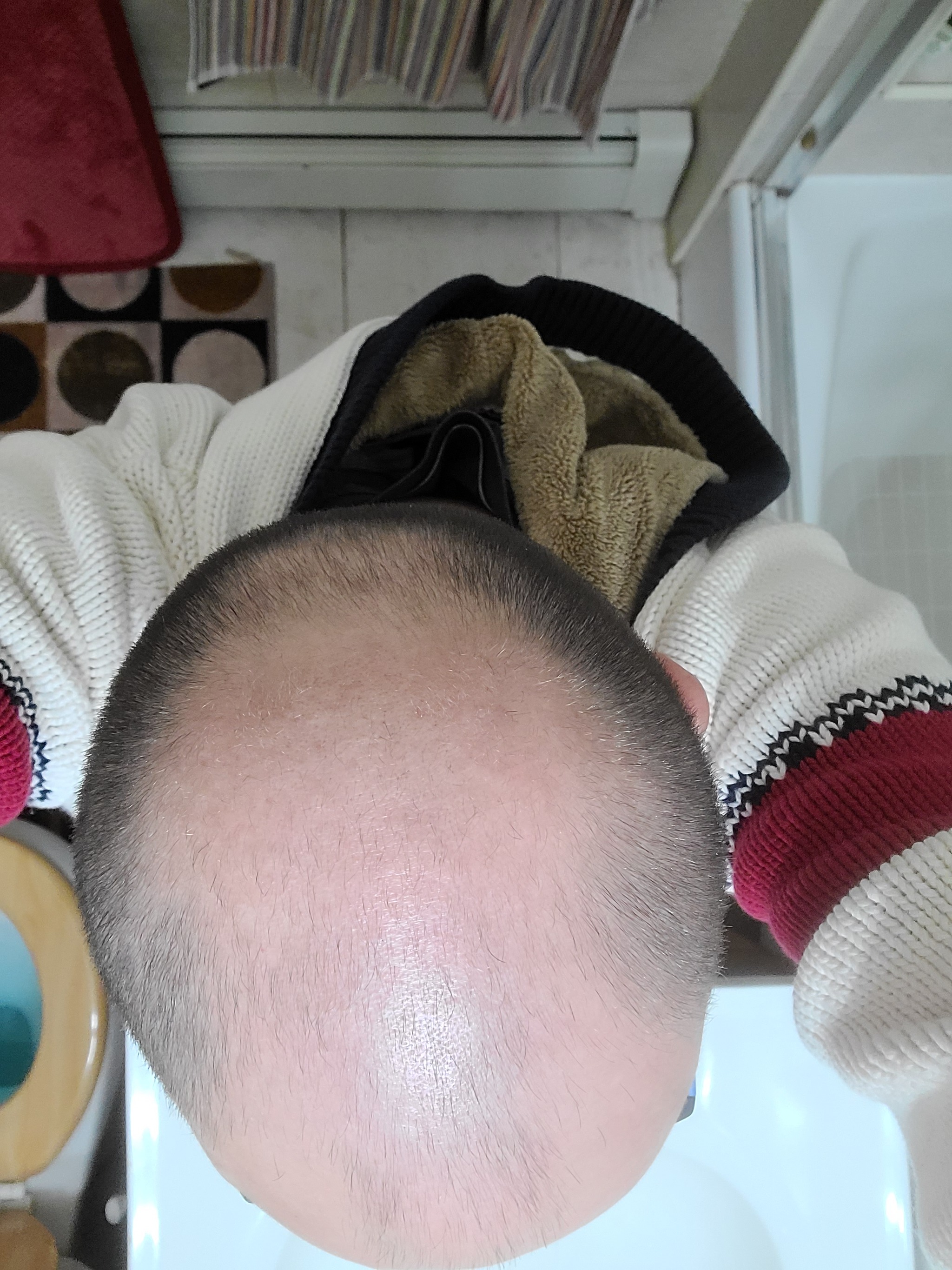 My experience with the hair system, or how to go from bald to hairy - My, Стрижка, Age, Longpost, Baldness, Wig, Personal experience