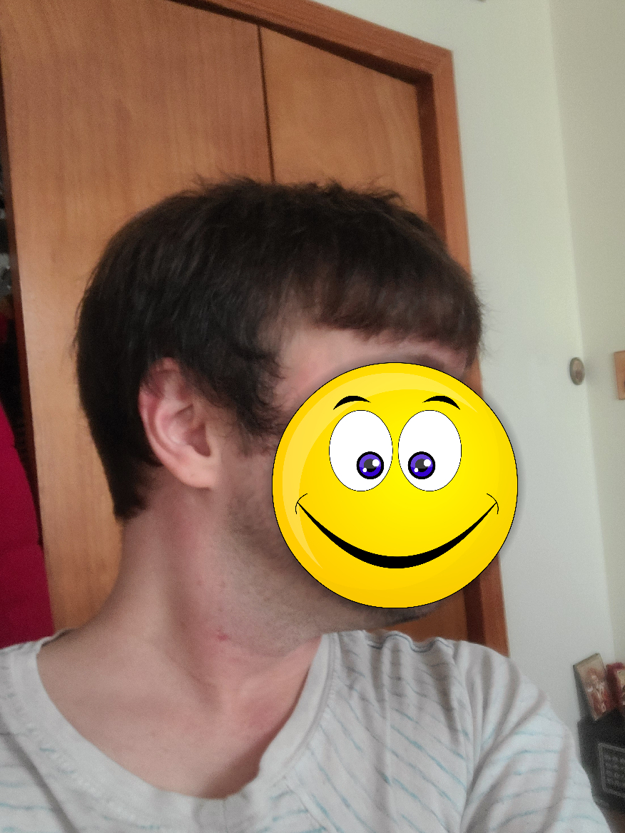 My experience with the hair system, or how to go from bald to hairy - My, Стрижка, Age, Longpost, Baldness, Wig, Personal experience