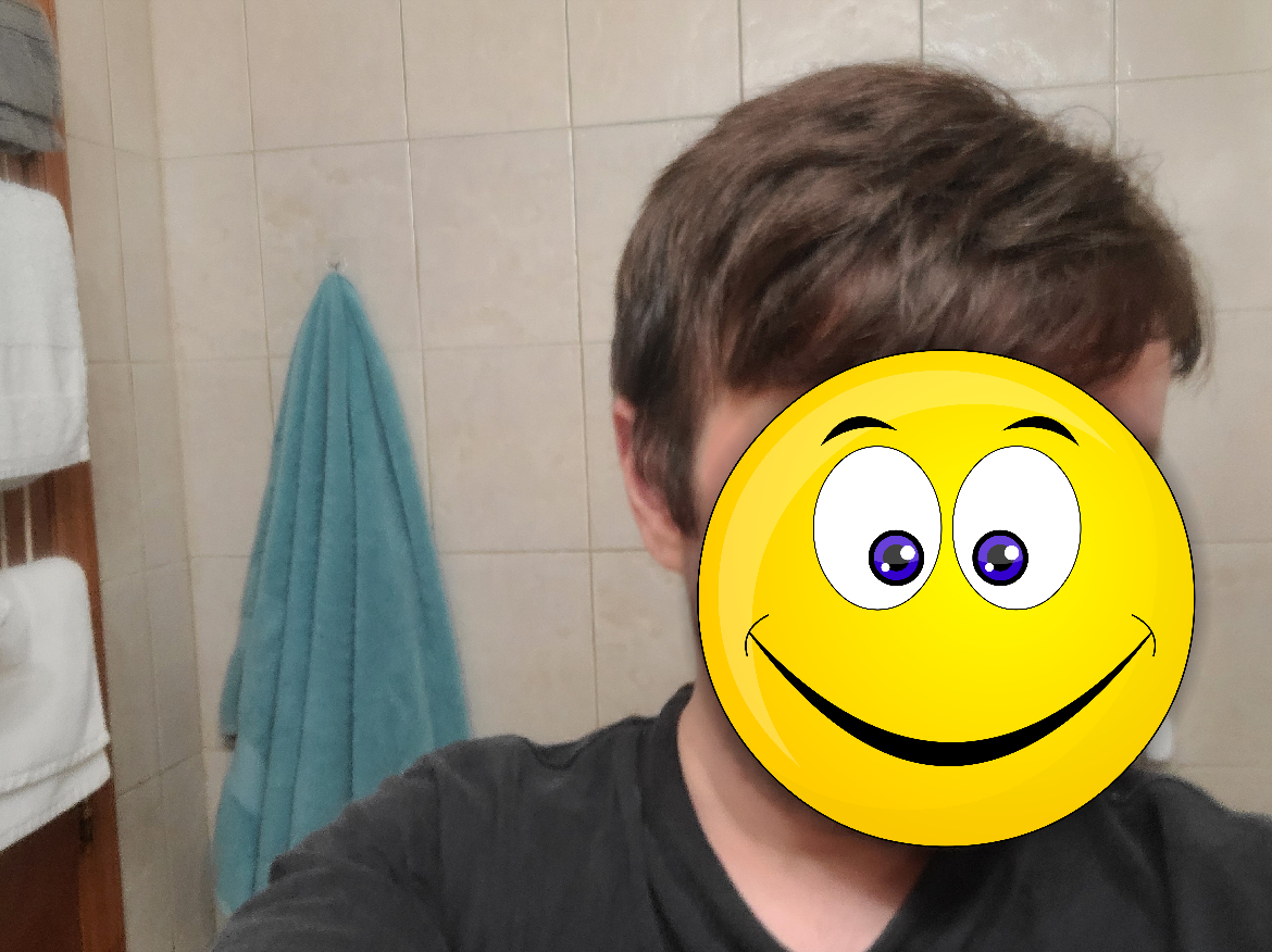 My experience with the hair system, or how to go from bald to hairy - My, Стрижка, Age, Longpost, Baldness, Wig, Personal experience