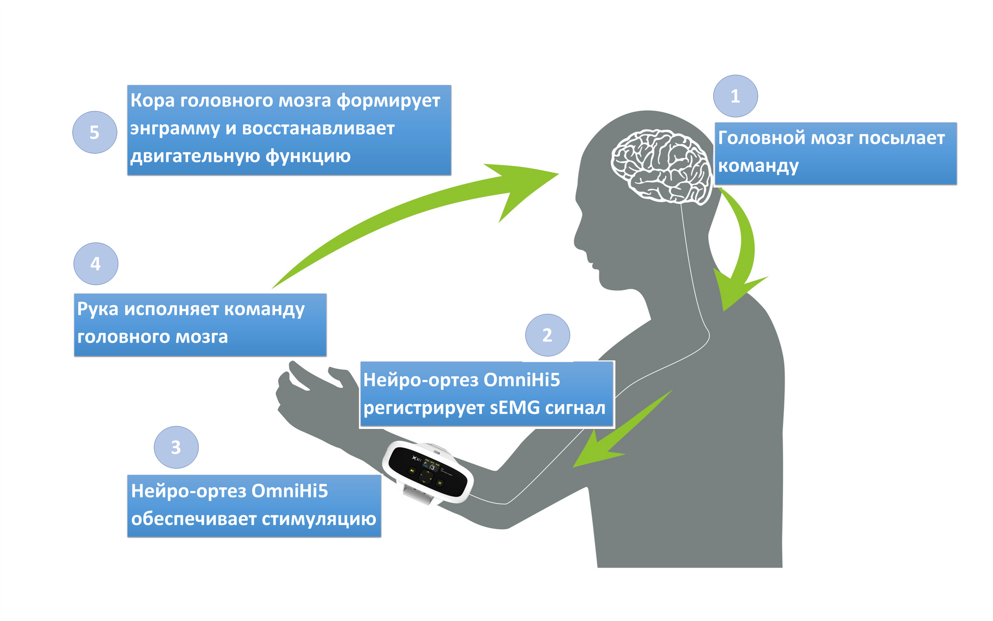 FES in the treatment of strokes - My, Health, Stroke, Rehabilitation, Longpost