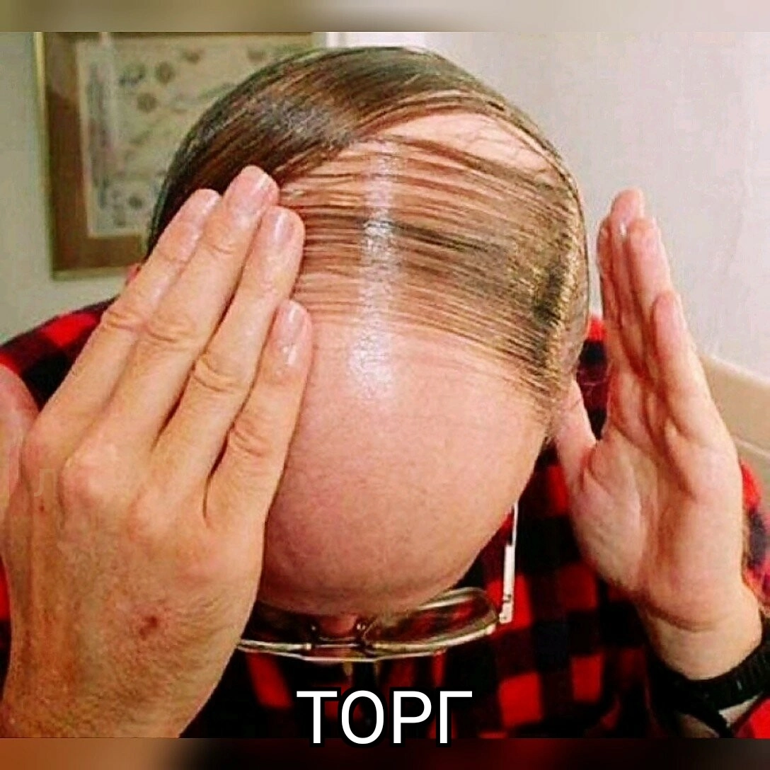 There are five stages of hair loss: - My, Стрижка, Humor, The hairdresser, Bald head, Longpost