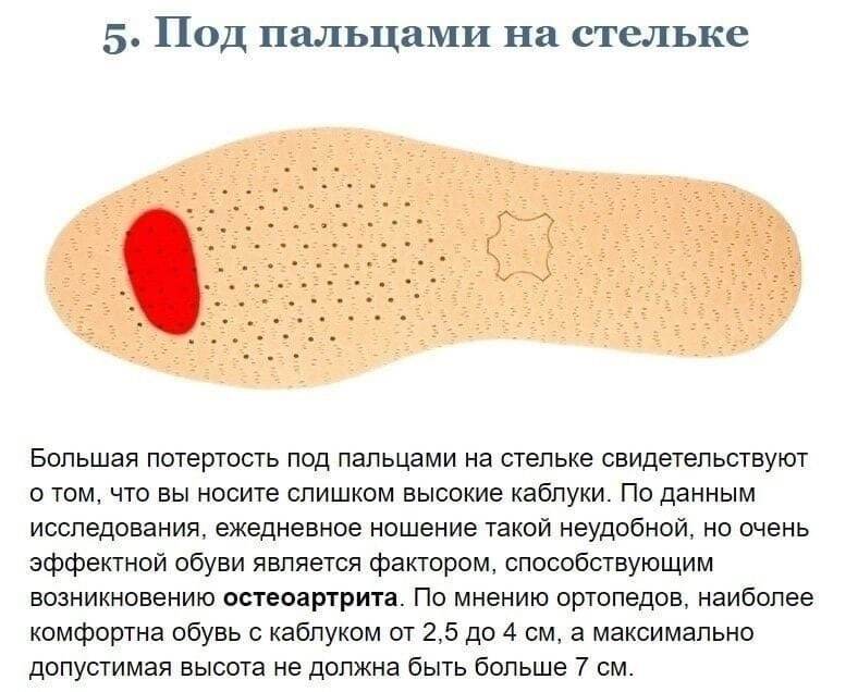 Стиральные подошвы, при неправильной ходьбе! - Бег, ЗОЖ, Ходьба, Похудение, Поход, Длиннопост