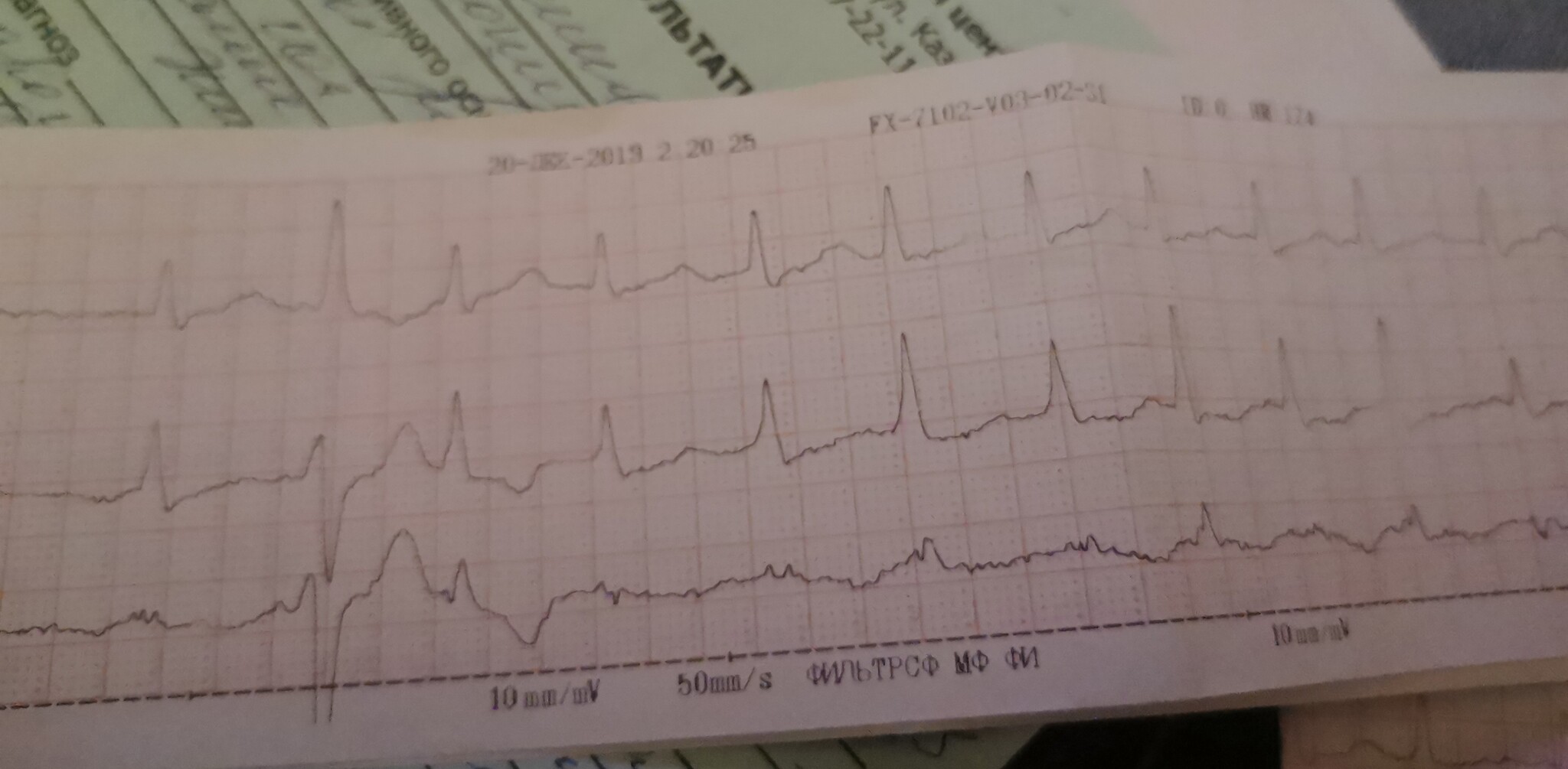 Response to the post “What is happening with medicine in Russia?!!!” - My, Doctors, Hospital, Treatment, Text, Mat, Reply to post