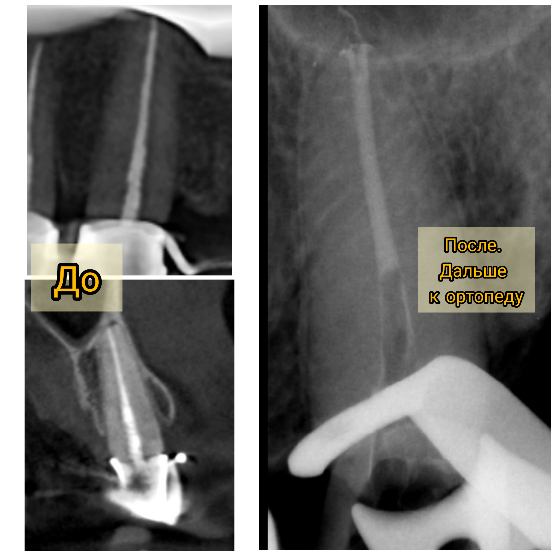 I don't know why you... - My, Dentistry, Teeth, Thoughts, Longpost