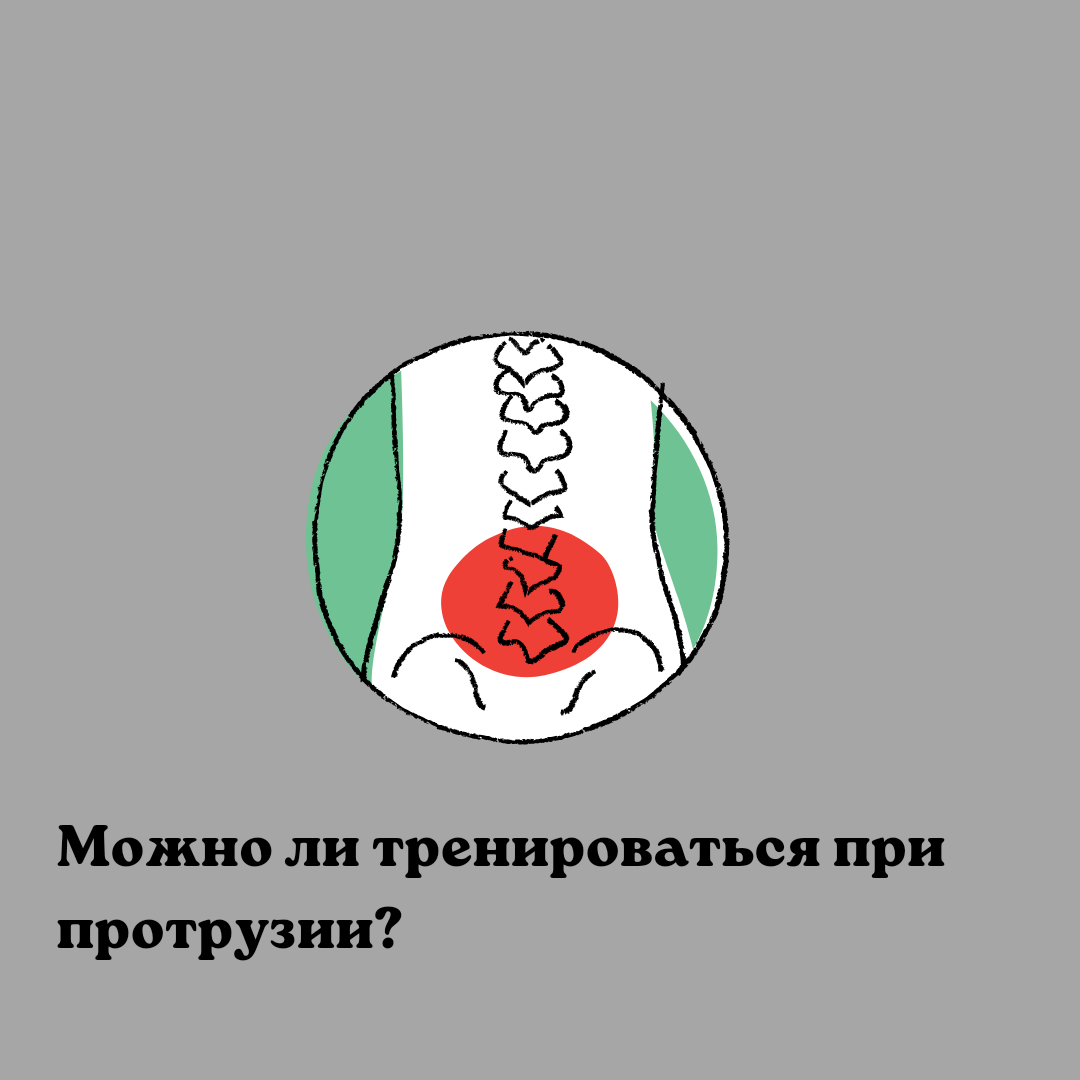 Можно ли тренироваться при протрузии? | Пикабу