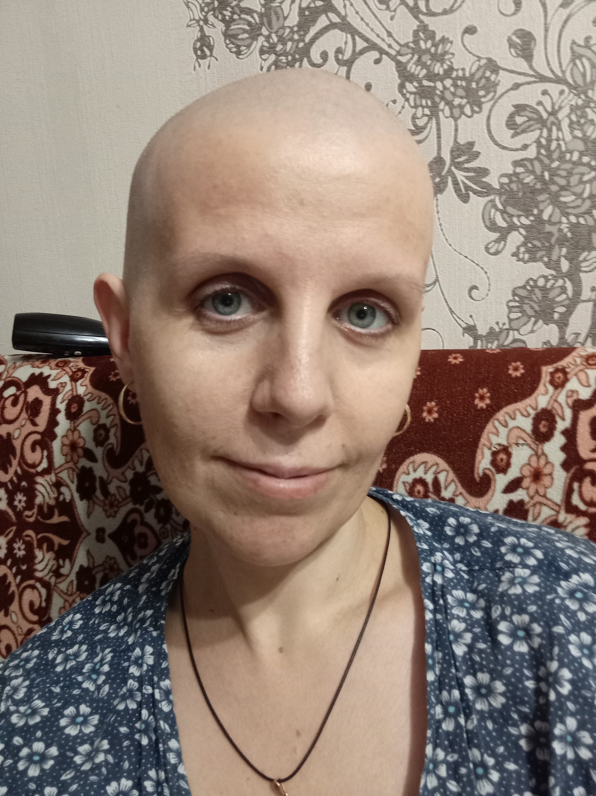 My life is like a constant battle - My, Cancer and oncology, Disease, Health, Life stories