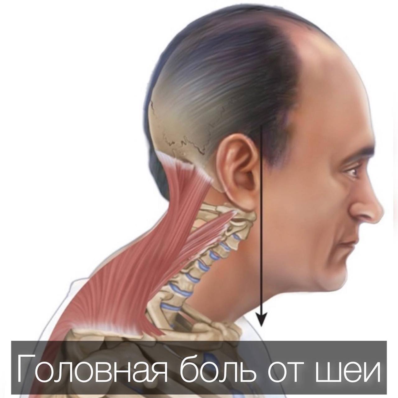Причины боли в шеи и затылке сзади, лечение головной боли в области затылка и шеи | Клиника Temed