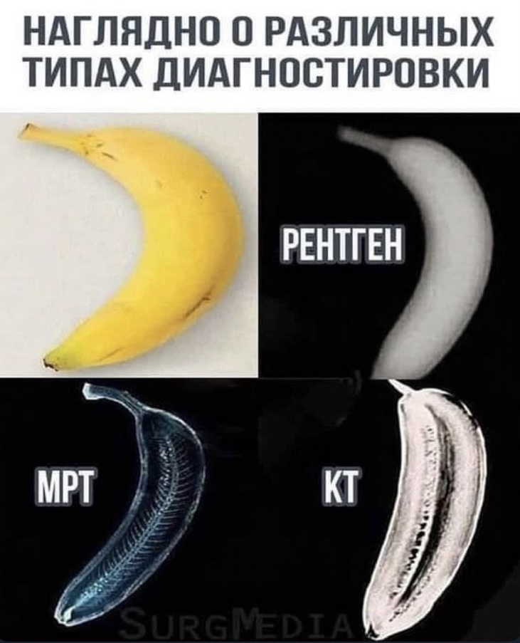 banana spine - X-ray, MRI, Diagnostics, Banana, Repeat, Picture with text