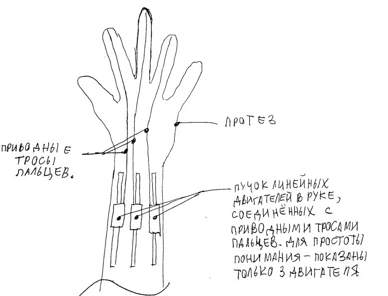 Бионические протезы и как их производить дешевле и быстрее - Протезирование, Инновации, Развитие, Видео, YouTube