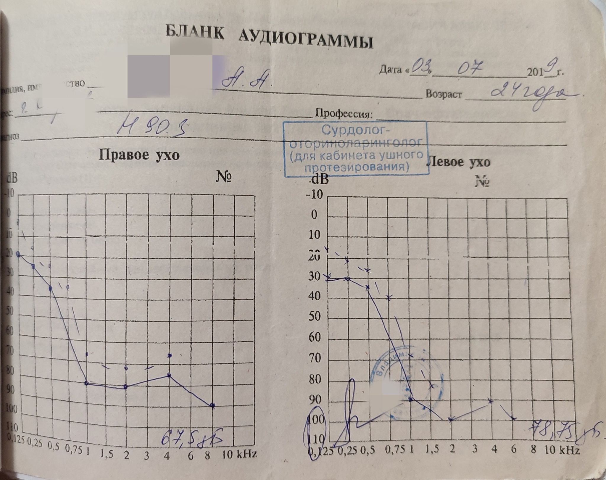 Прогрессирующая потеря слуха: каково быть героем фильма 