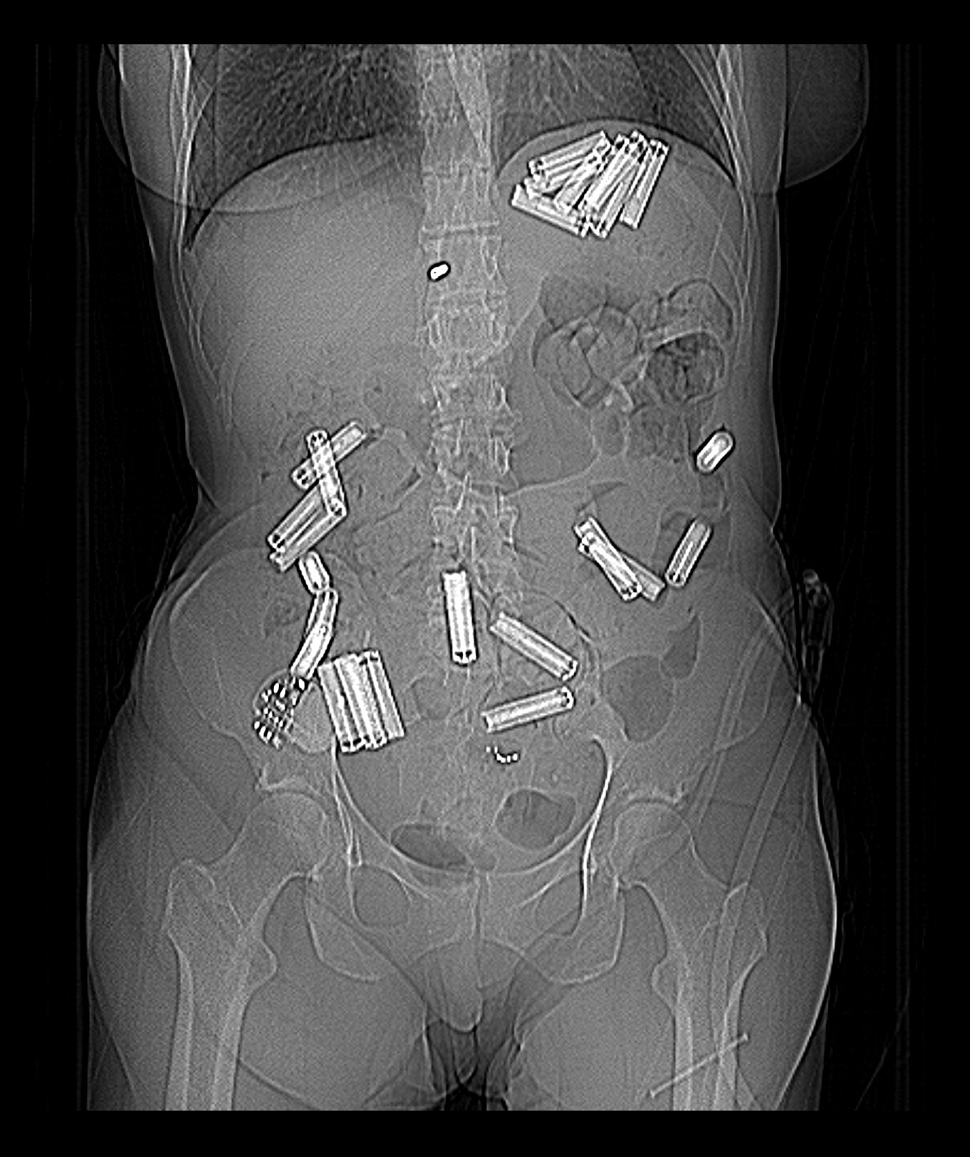 Case study: a lover to recharge - My, Personal experience, Radiology, CT, Psychiatry, Video, Soundless, Vertical video, Longpost, Mental disorder