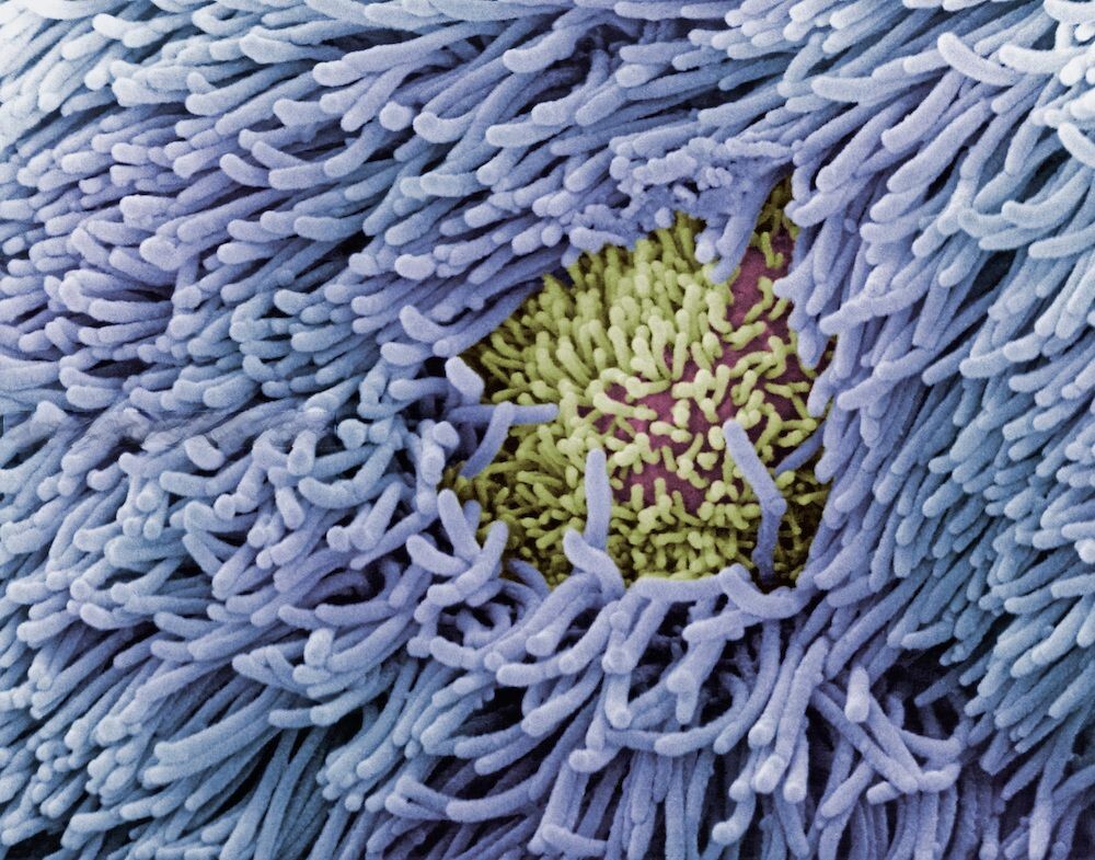 Бактерии хозяева. Кишечная палочка электронный микроскоп. Бактерии под электронным микроскопом. Как выглядят микробы под микроскопом. Микробы под ногтями под микроскопом.