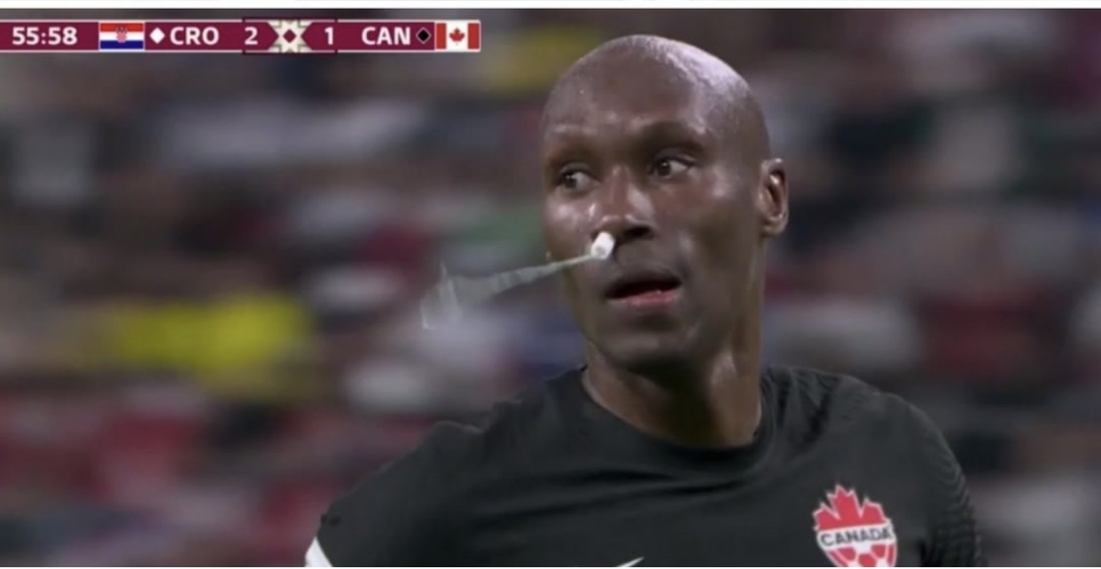 The original way to stop the bleeding - Football, Blood, Tampon, FIFA World Cup 2022, Team Canada