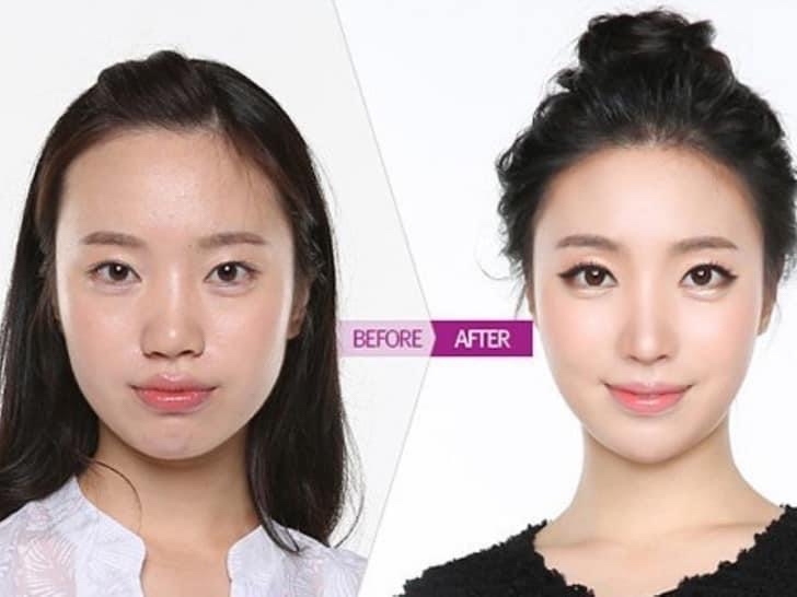 About the cult of beauty in South Korea - My, South Korea, Plastic surgery, Travels, Useful, Longpost