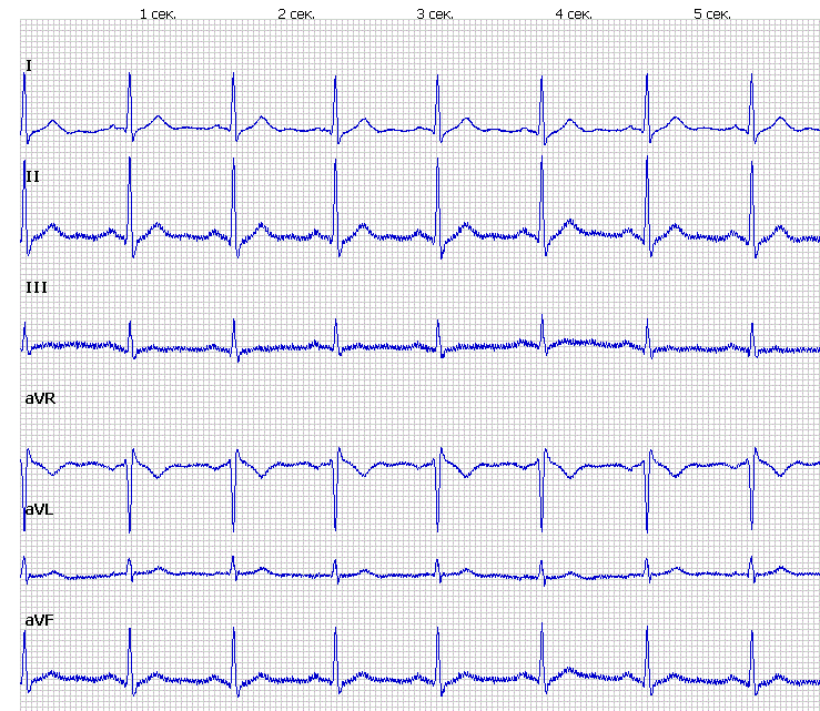 Cardiac arrest and defibrillator - My, Educational program, The medicine, Resuscitation, Heart, Longpost