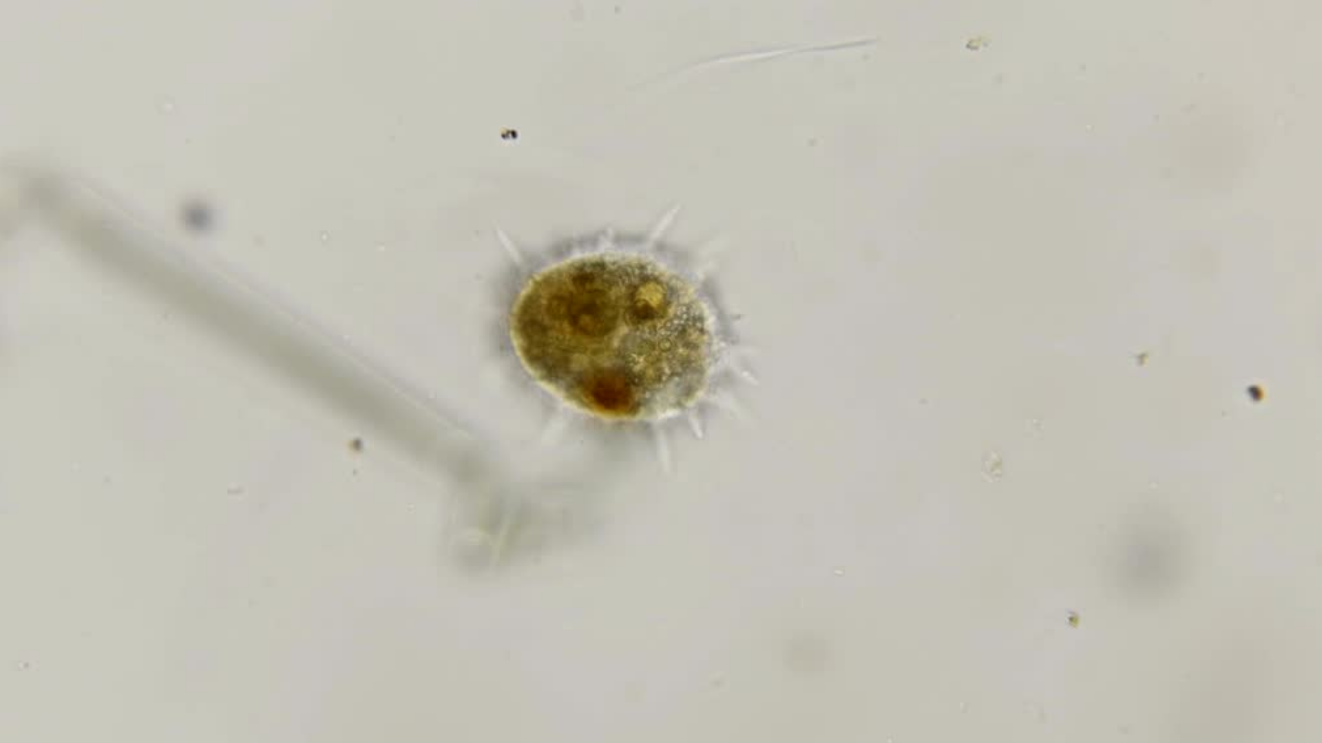 Раковинная амёба под микроскопом | Пикабу