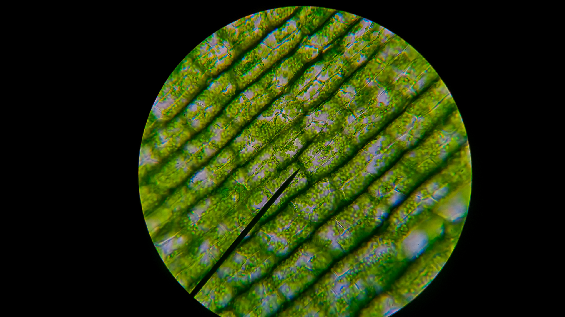 Хлоропласты микроскоп. Растение Элодея под микроскопом. Хлоропласты под микроскопом фото. Дендритные клетки в микроскопе. Chloroplast under Microscope.
